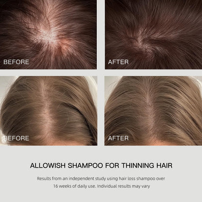 ALLOWISH Hair Loss Shampoo with Biotin, Ginger & Rosemary – Thickening & Hydrating