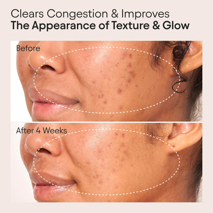 ALPYN Clarifying Facial Oil with Retinol & Pink Algae | Clear Congestion & Glow