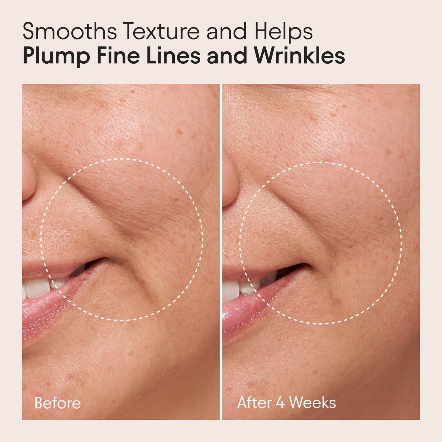 ALPYN Clarifying Facial Oil with Retinol & Pink Algae | Clear Congestion & Glow