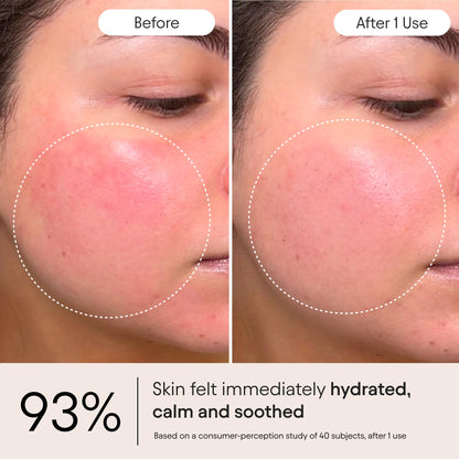 Alpyn Beauty Super Peptide & Ghostberry Moisturizer — Soothe Redness, Support Barrier & Wrinkles | 1.7 oz