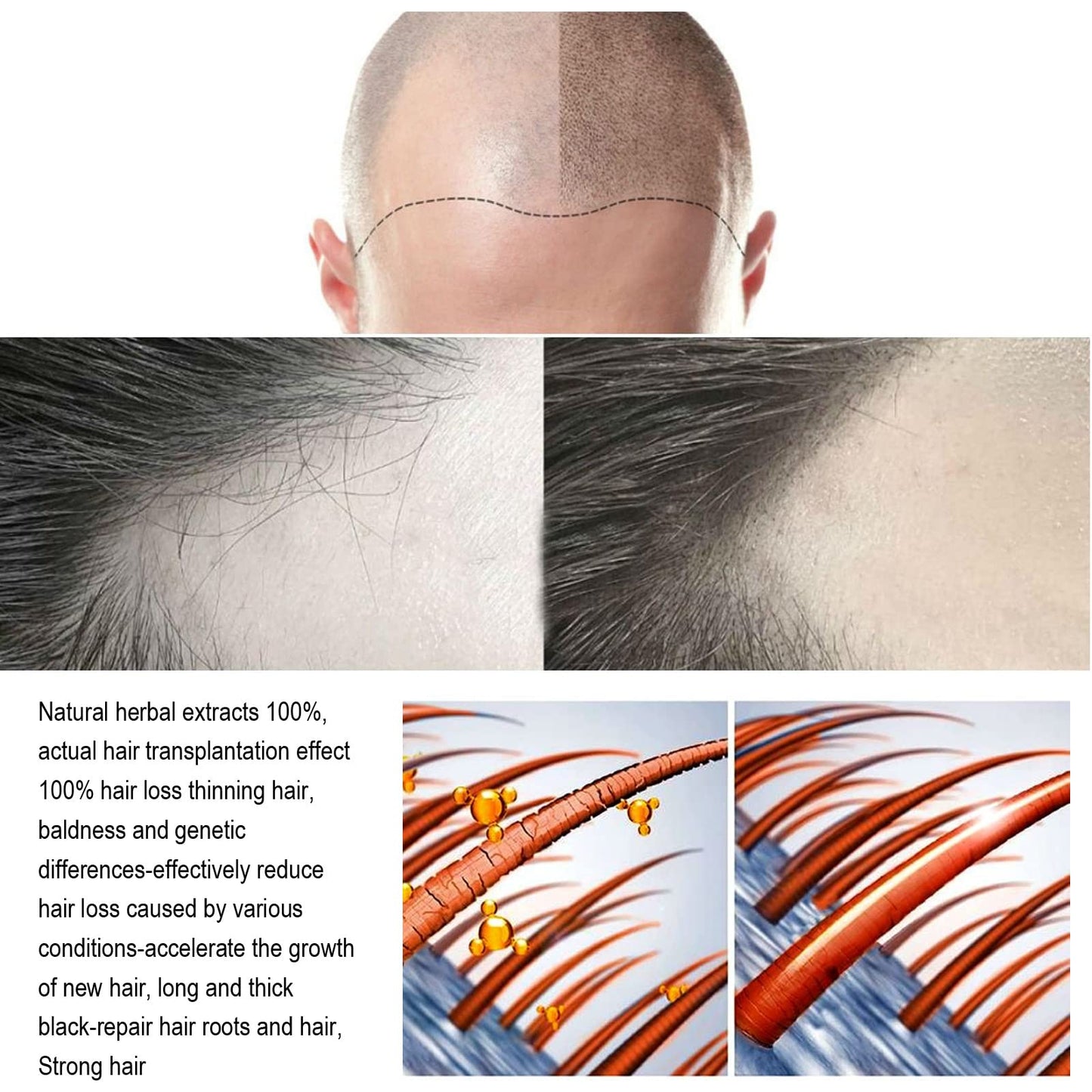 Hair Regrowth System | ANEFOSE — Ginseng, Eclipta Prostrata, Peppermint Oil & Ginger Root for Thicker Hair