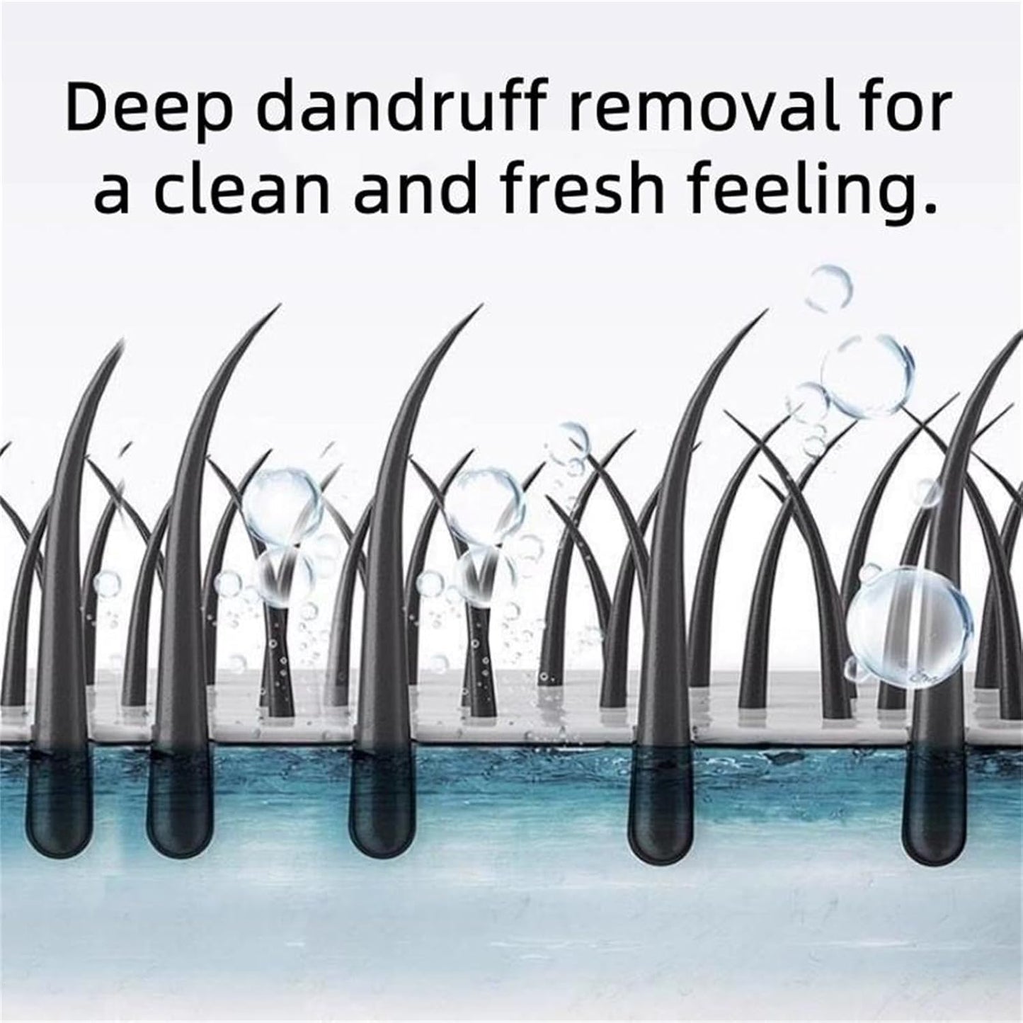 10.55 fl oz Anti-Dandruff Shampoo – Oil Control for All Hair Types (Men & Women)