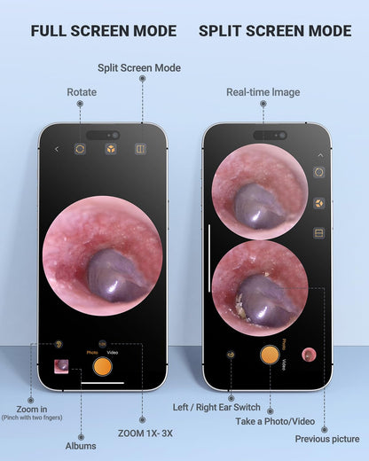 AnyScope HD Digital Otoscope — Ear Camera with Light, iPhone & Android Compatible (Silver)