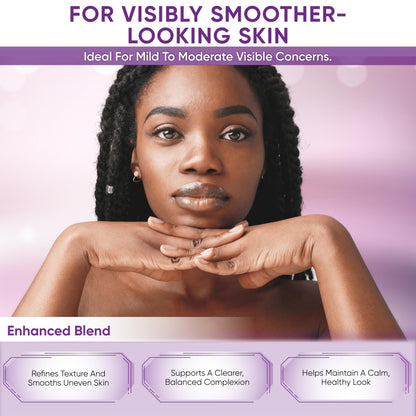 AOBBIY Azelaic Acid Cream for Face – Redness-Soothing, Even Tone, Pore Care (1 oz)