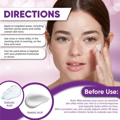 AOBBIY Azelaic Acid Cream for Face – Redness-Soothing, Even Tone, Pore Care (1 oz)