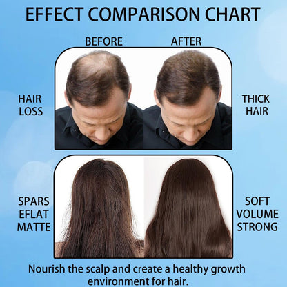 Aparthy Hair Growth Roll-On – Rosemary Serum for Thicker, Stronger Hair (3pcs)