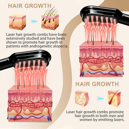 Apbier Laser Hair Growth Comb – At-Home Laser Therapy for Hair Growth