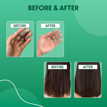 Aravi Organic Rosemary Anti Hairfall & Hair Growth Shampoo & Conditioner Combo | Sulphate-Free | For Dry & Frizzy Hair | 200ml Each