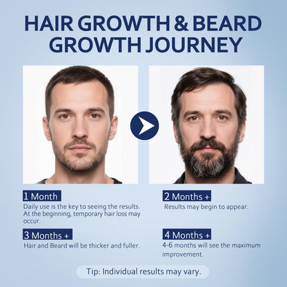 Artimore 5% Minoxidil Hair Growth Serum for Men & Women – Extra Strength, 4 Fl Oz x 2 Bottles