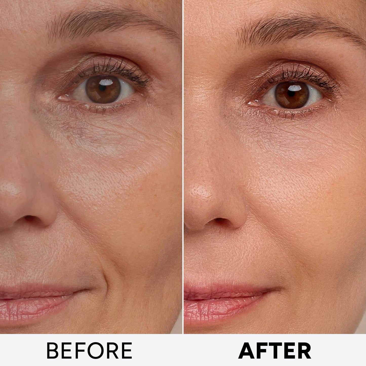 Arvesa 2 Pack Retinol Cream with Collagen & Hyaluronic Acid – Anti Aging Day & Night Moisturizer