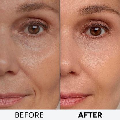 Arvesa 2 Pack Retinol Cream with Collagen & Hyaluronic Acid – Anti Aging Day & Night Moisturizer
