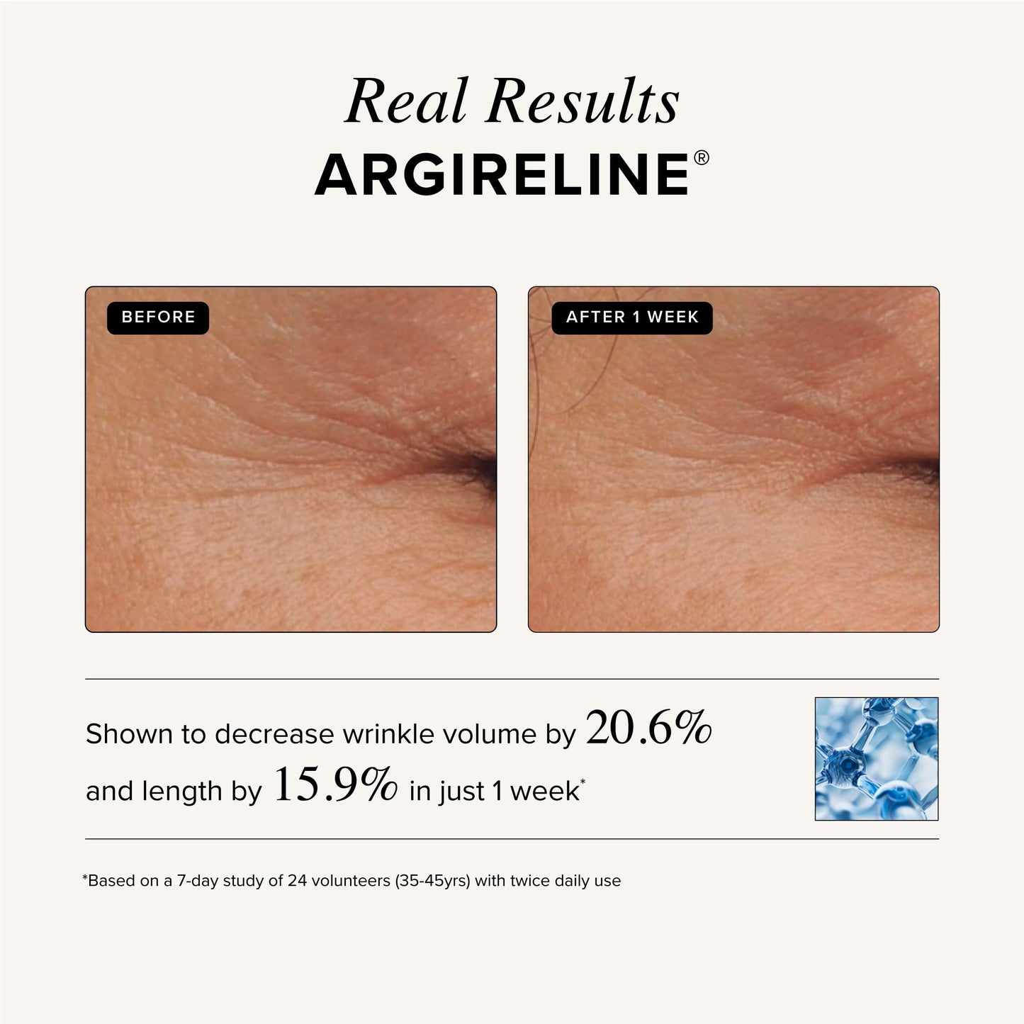 Asterwood Argireline Serum with Hyaluronic Acid – Peptide Serum for Face, Fragrance-Free, 2 oz