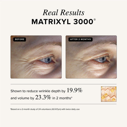 Asterwood Triple Repair Serum – Matrixyl 3000 + Argireline + Vitamin C + Hyaluronic Acid | Fragrance-Free, 2 oz