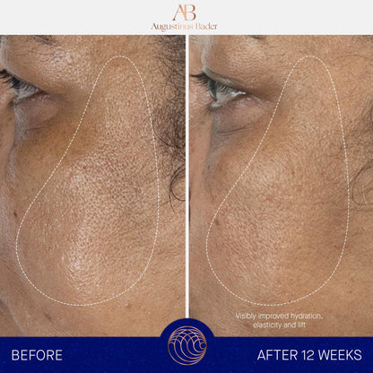 Augustinus Bader The Serum – Hydrating Anti-Aging Serum for Firmer, Smoother Skin (15 ml)