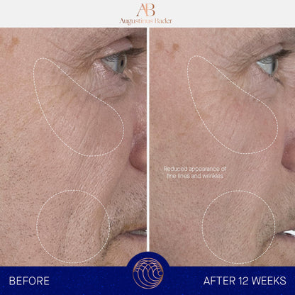 Augustinus Bader The Serum – Hydrating Anti-Aging Serum for Firmer, Smoother Skin (15 ml)