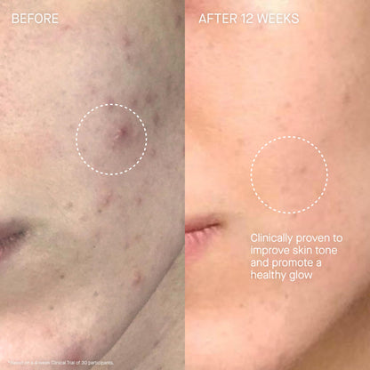 Augustinus Bader The Cream – Luxury Hydrating Face Moisturizer