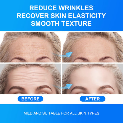 Auteek Forehead Wrinkle Patches Overnight – Collagen & Seaweed (20 Count)