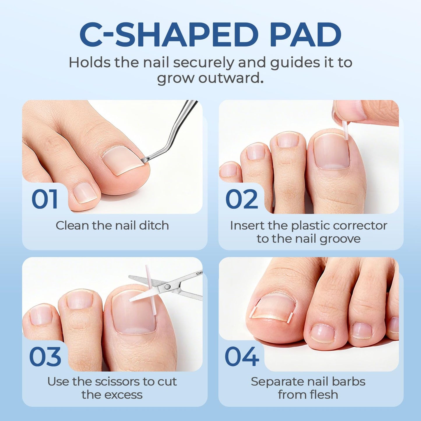 awrose Ingrown Toenail Corrector Set with Correction Strips | At-Home Pedicure Kit for Men & Women