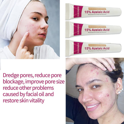 Azelaic Acid Serum for Face – Balance Skin Tone & Purify Pores, Acne Relief, Premium Skin Care, 20g