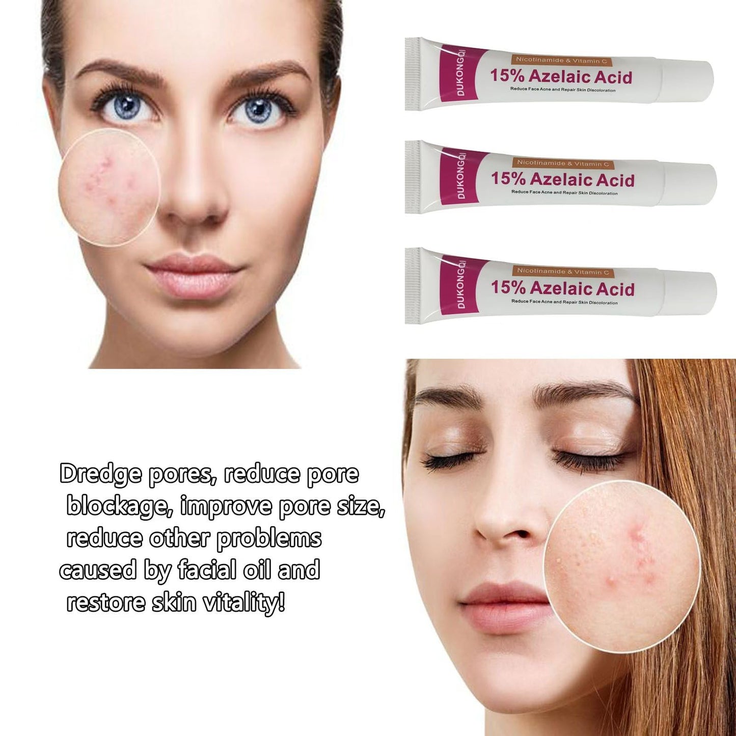 Azelaic Acid Serum 12% for Balanced Skin Tone & Purified Pores, 20g