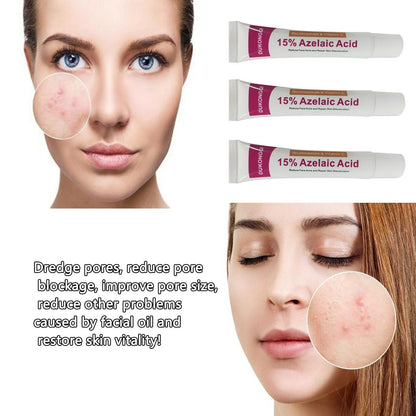 Azelaic Acid Serum 12% for Balanced Skin Tone & Purified Pores, 20g