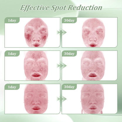 Bablabear 2% Salicylic Acid Acne Cream – Face, Back & Body (30g)
