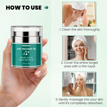 Bablabear 2% Salicylic Acid Acne Cream – Face, Back & Body (30g)