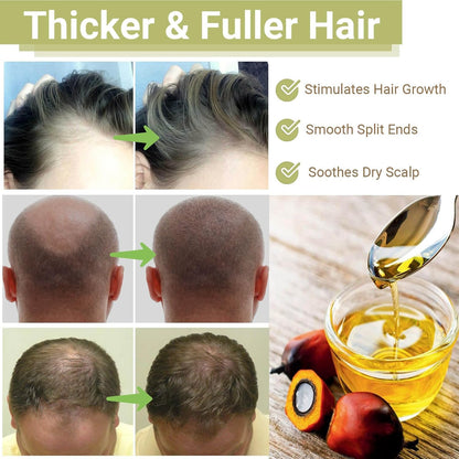 BALPPRD Lifewitqueenp Hair Growth Oil — Ayurvedic Care for All Hair Types