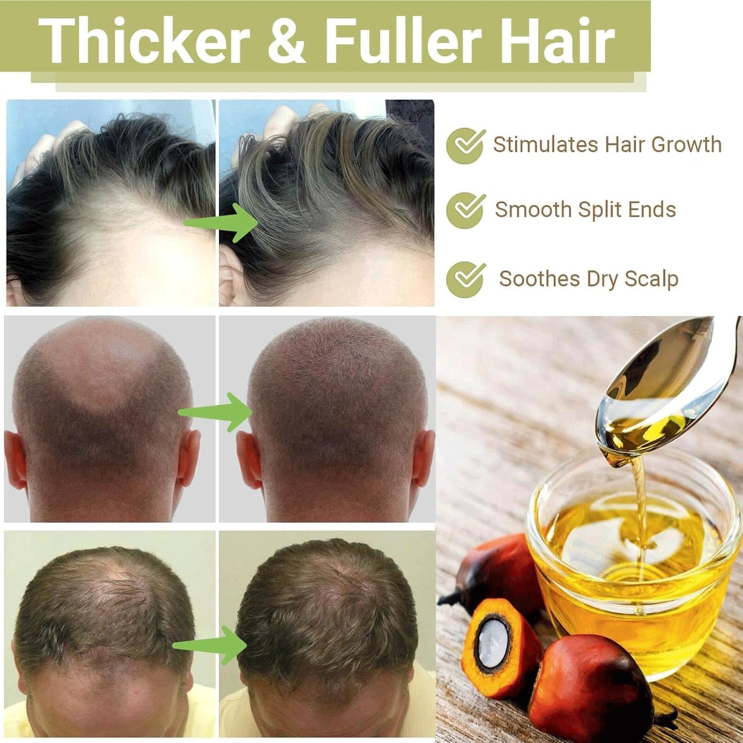 BALPPRD Minnah Batana Oil for Hair Growth – 4-in-1 Nourishing Hair Oil