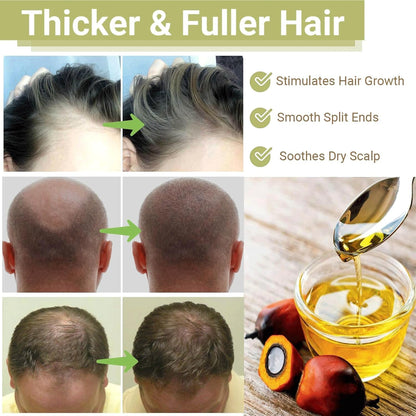 BALPPRD Minnah Batana Oil for Hair Growth – 4-in-1 Nourishing Hair Oil