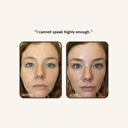 Barefaced Retinal Skin Therapy 30ml – Retinaldehyde & Bakuchiol Serum for Firming, Smoothing & Even Tone