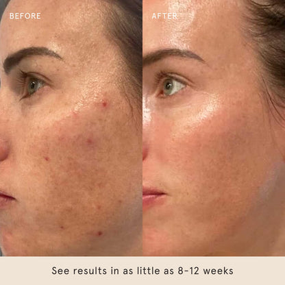 Barefaced Retinal Skin Therapy 30ml – Retinaldehyde & Bakuchiol Serum for Firming, Smoothing & Even Tone