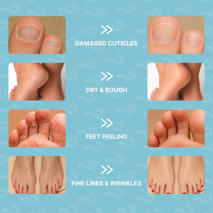 Foot Mask Moisturizing Socks for Dry Cracked Feet | Bayside Hydrates with Snail Mucin, Shea Butter & Hyaluronic Acid