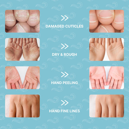 Bayside Hand Mask Moisturizing Gloves - Deep Hydration with Snail Mucin