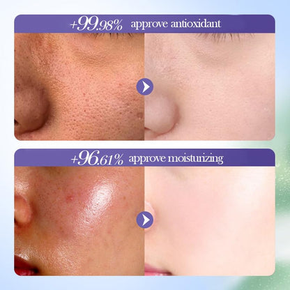 BeauBase Blueberry Skin Care Set (6 PCS) – Nourishing & Hydrating Routine