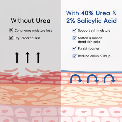 BeauBase 2 Pack Urea Cream 40% + 2% Salicylic Acid – Deep Hydration for Feet & Hands (3.53 oz)