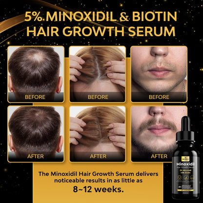 Beaueli 5% Minoxidil for Hair & Beard Growth — Unscented Foam, 3 x 3oz