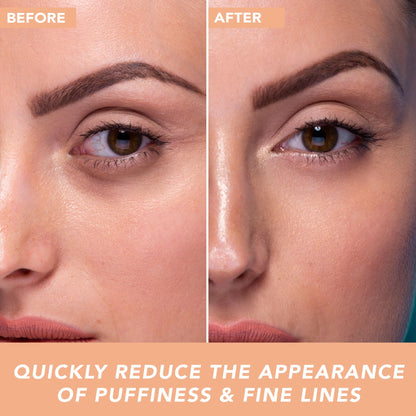 Beauty by Earth Under Eye Cream – Cooling Hyaluronic Acid Eye Gel for Dark Circles