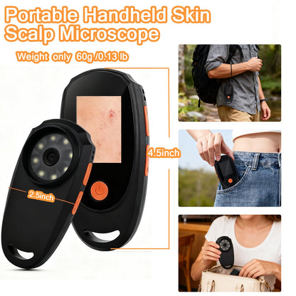 Beauty Star Dermatoscope 500x – Handheld Skin & Scalp Microscope, 8 LED, 1080P Display