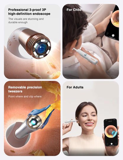 BEBIRD Earsight Plus Ear Wax Removal Tool Camera – 1080P WiFi Visual Otoscope