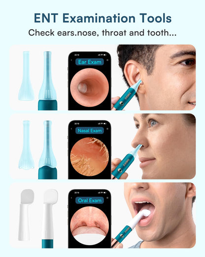 BEBIRD Earsight Ultra Ear Wax Removal Kit with 2K HD Camera | 90-Min Battery, Visual Ear Cleaner