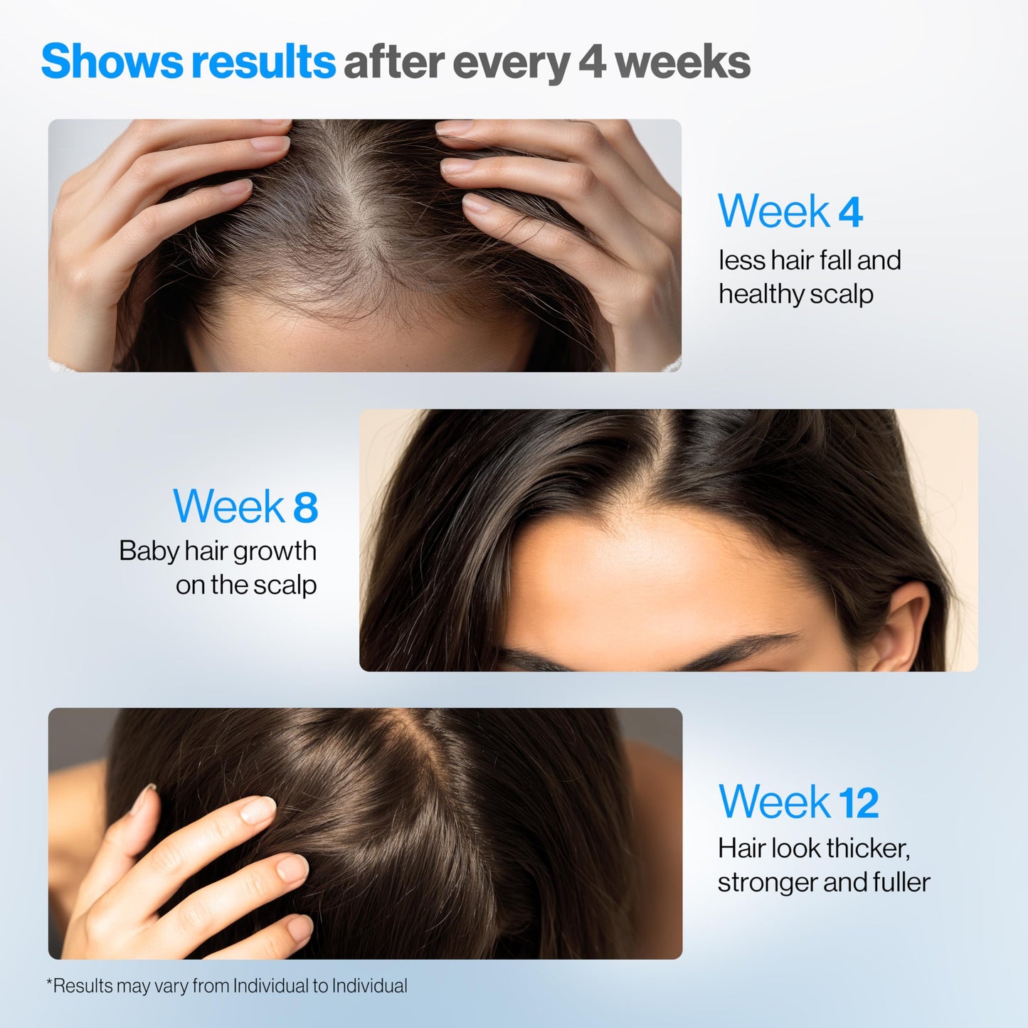 Be Bodywise Rosemary Hair Growth Serum Roll-On 50 ml – 3% Rosemary, 3% Redensyl, 2% Anagain