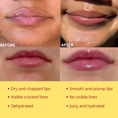 Bee Balm Original Lip Balm – Propolis Hydration in Honey Pot (Pack of 2)