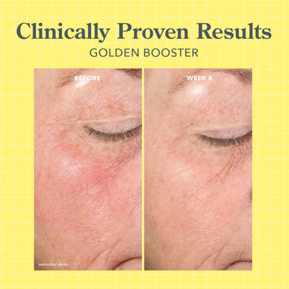 Beekman 1802 Golden Booster Amla Berry Serum – Fragrance-Free, Plant-Based Vitamin C Alternative (0.5 fl oz)