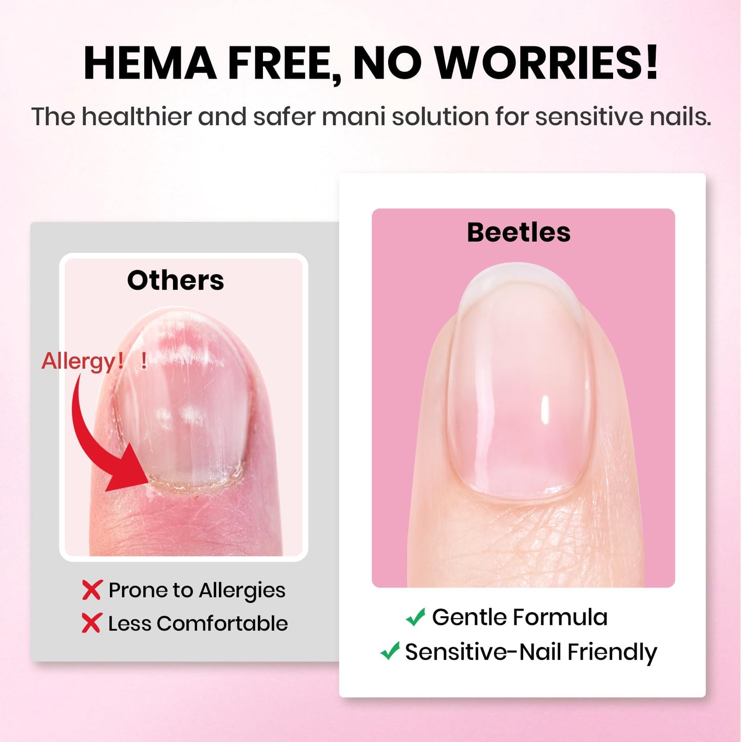 Beetles Gel Nail Kit Etch-X: 288 Tips (12 Sizes) + HEMA-Free Glue, Base & Top Coats