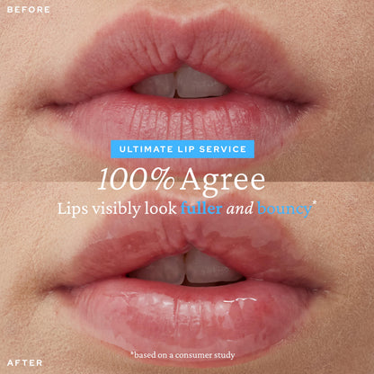 Belif Super Knights Lipcerin Lip Balm | Hyaluronic Acid & Vitamin C | Hydration & Plumping