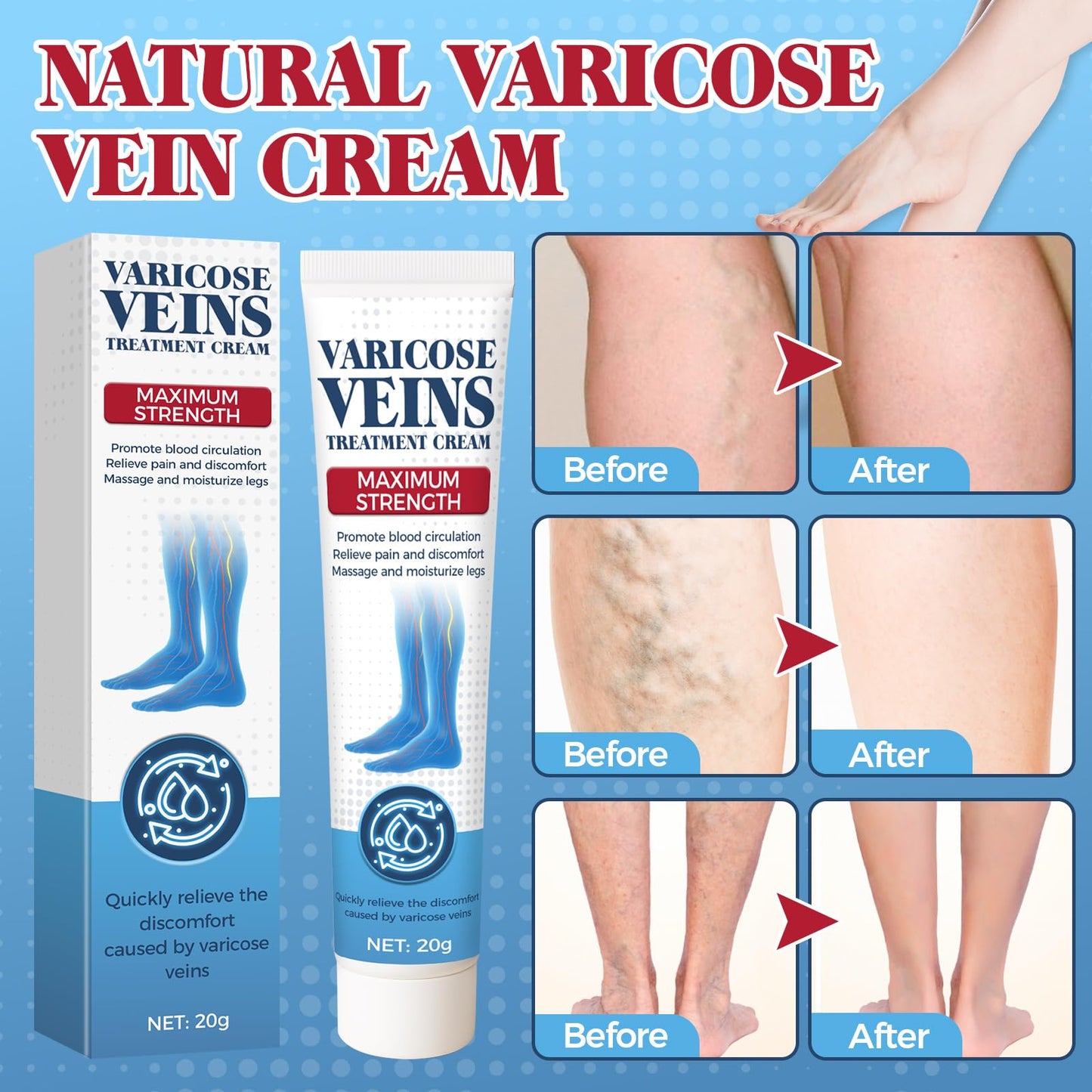 Bellisinno Varicose Veins Cream for Legs – Soothe Tired Legs, Improve Circulation
