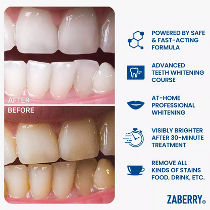 Advanced Teeth Whitening Maxi Kit