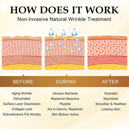 BERVEAL Face Wrinkle Patches - 160 Patches for Overnight Smoothing of Eye, Forehead & Mouth