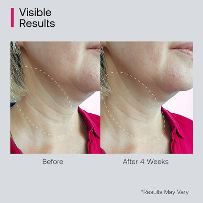 Bestkiss Neck Cream for Tightening & Firming with Roller Applicator | Retinol, Niacinamide & Hyaluronic Acid